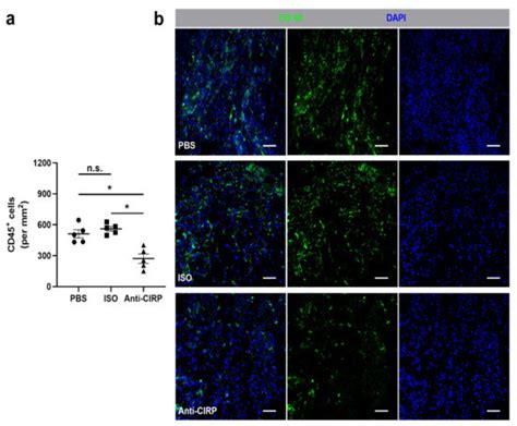 The Absence of Extracellular Cold-Inducible RNA-Binding Protein (eCIRP ...
