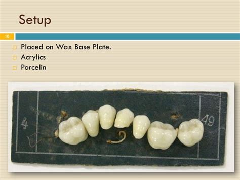 Image result for Partial Denture Procedure