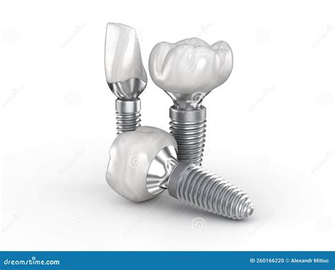 Ceramic Crowns, Custom Implant Abutment and Implantats. Medically Accurate 3D Illustration of ...