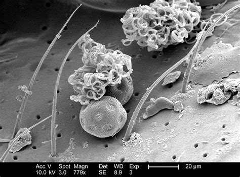 Microscopic Insects 的图像结果