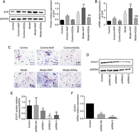 Figure 5 from Nerve growth factor causes epinephrine release ...