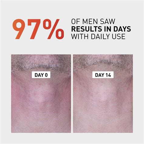 Post Shave Razor Bump Treatment & Cream | Frederick Benjamin