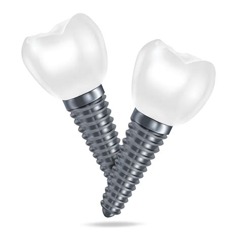Vector 3d realistic rendering of white dental implant dentures closeup isolated on white ... - dental implant images