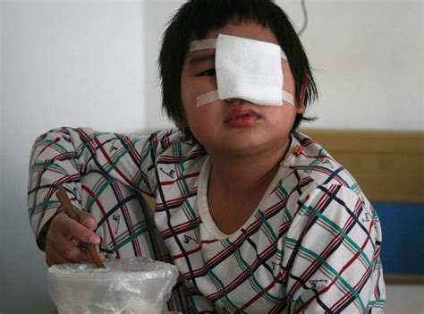 男孩被扇40多耳光，导致左眼失明，只因没写完作业 -家事闲谈-孩爸妈聊天室-台州19楼