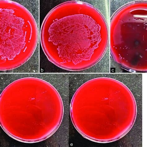 Image result for Enterococcus Faecalis MSA Plate