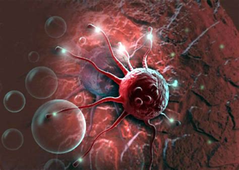 Tumor Lysis Syndrome