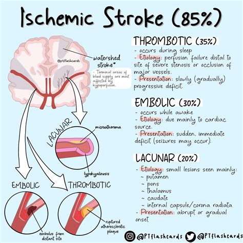 Brain Stroke: Types, Causes, Symptoms, Prevention And, 50% OFF