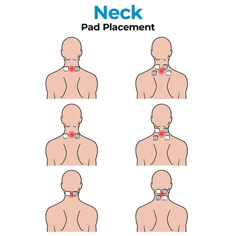 Why Is There A Line On The Back Of My Neck at Roger Monday blog