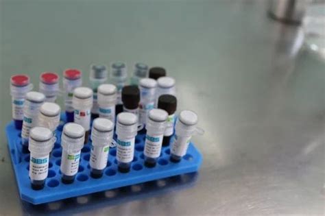 Protein Ladders & Protein Markers - bLU Prestained Protein Ladder And ...