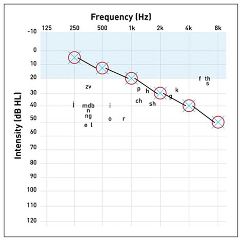 Audiogram Types and examples 的图像结果