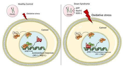 The BACH1/Nrf2 Axis in Brain in Down Syndrome and Transition to ...