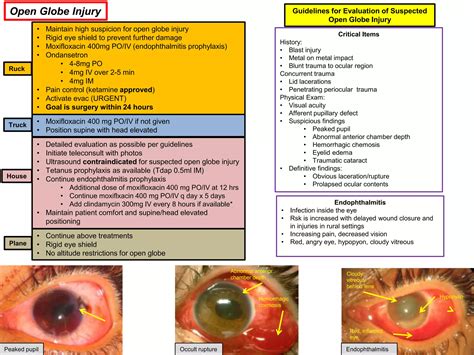 Open globe injury | PPT