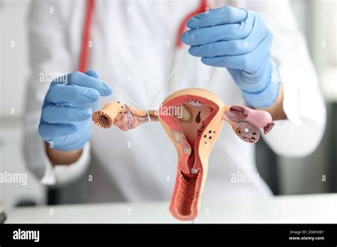 Image result for Removing Fallopian Tubes
