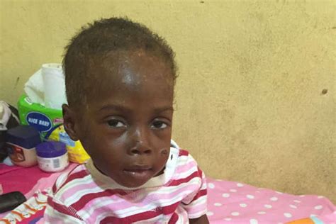 Boy who was rejected for being a ‘witch child’ is thriving eight years ...