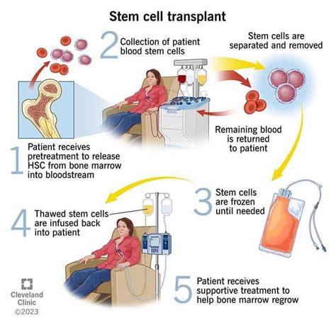Stem Cell Process 的图像结果