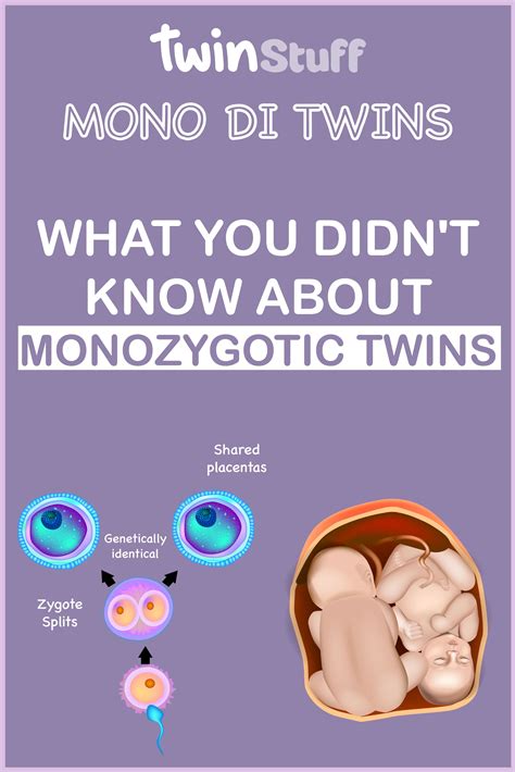 Identical twin pregnancy risks why you do need all those appointments ...