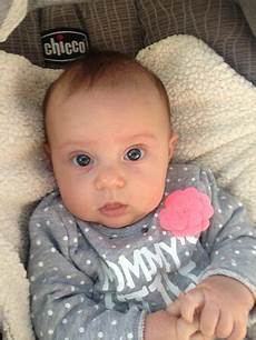 Do Newborns Lose Hair by Babys Losing Hair Babycenter Do Newborns Lose Hair