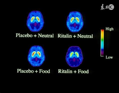 多巴胺转运体的脑内分布与功能