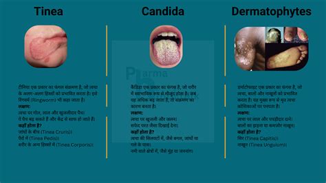 कैंडिड बी क्रीम के फायदे: उपयोग, साइड इफेक्ट्स और सावधानियां ...