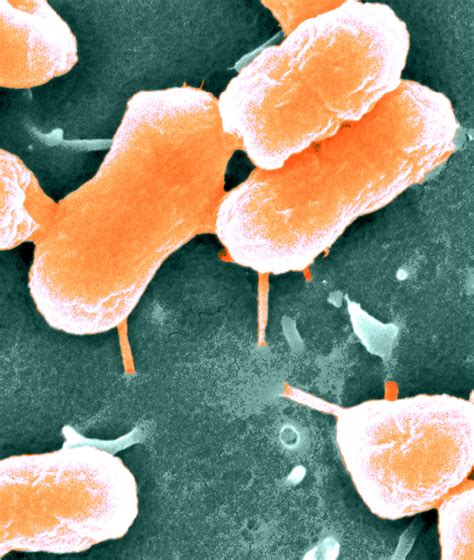 Image result for Host-Pathogen