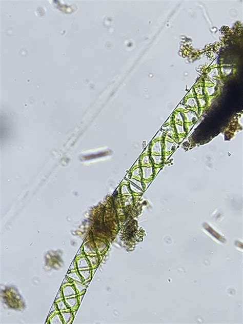 Spirogyra Under Compound Microscope
