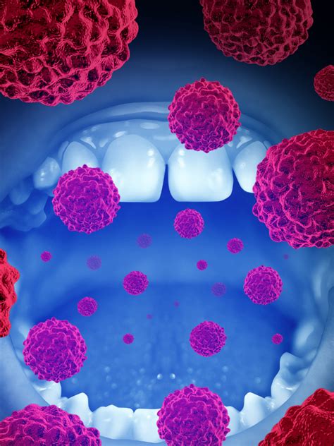 8 early signs of oral cancer common in patients | Times of India