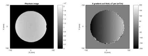 Stability of Gradient Field Corrections for Quantitative Diffusion MRI | Medical-image Analysis ...