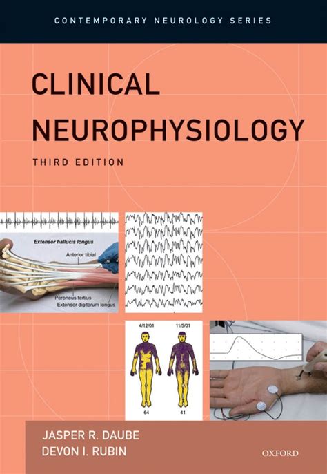 Clinical Neurophysiology (Contemporary Neurology Series Book 75) eBook ...