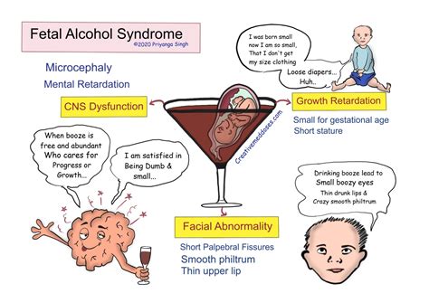 How Do Doctors Test For Fetal Alcohol Syndrome at Donna Hammonds blog