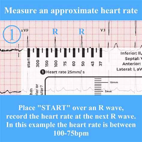 WLLEADG 2PCS ECG 7 Step Ruler, ECG 7 Step Ruler for ECG/EKG India | Ubuy