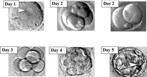 Image result for Early Embryo Development