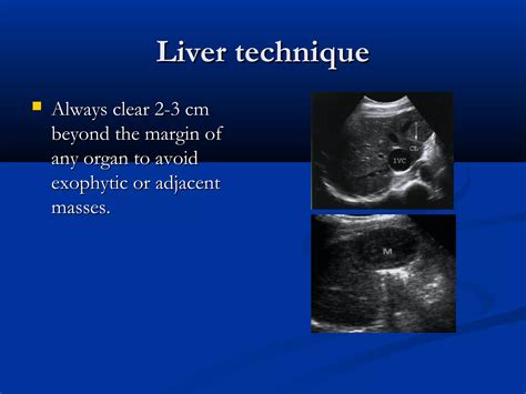 Liver ultrasound | PPT