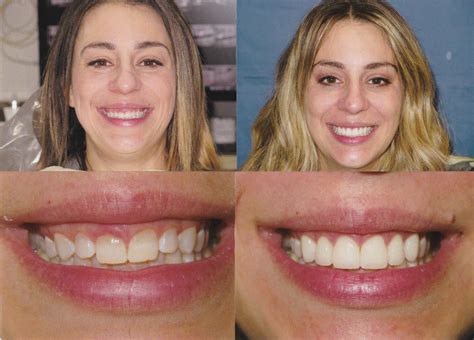 Dental Professionals Of Lincoln Park at Anna Beyers blog