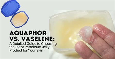 Aquaphor vs. Vaseline: The Right Petroleum Jelly for Your Skin | Clinikally