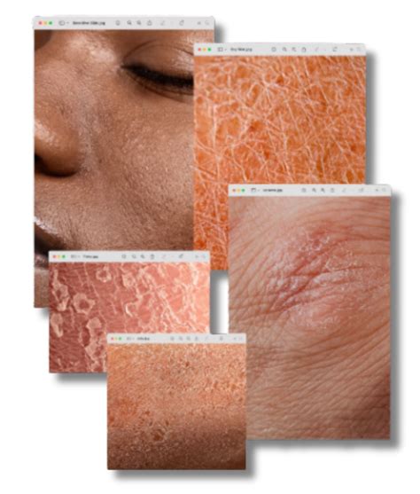 Skin Barrier Repair: Causes, Signs & How to Heal Safely – dot3b