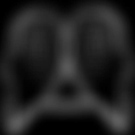 Image result for Angion Method Review