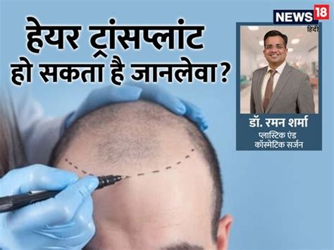 Hair Transplant Myths: क्या हेयर ट्रांसप्लांट करते वक्त बहता है खून ...