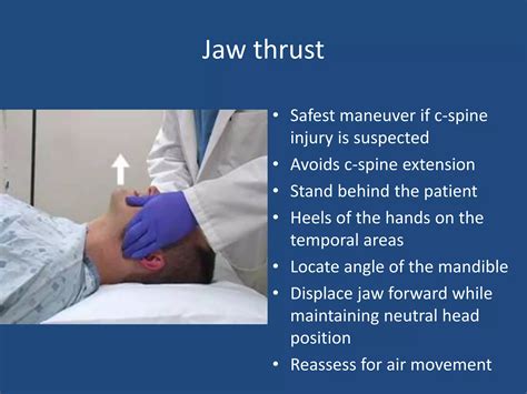 Basic airway management | PPTX