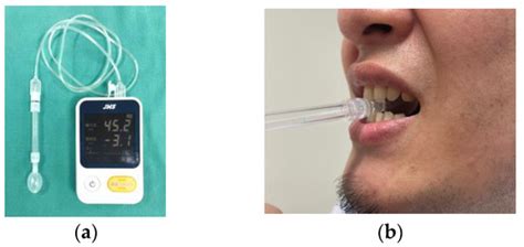 Comprehensive Analyses of Masticatory Function in Maxillectomy Patients ...