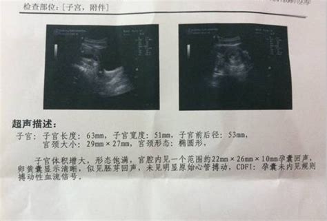 9月17末次月经_10月10去医院验血没怀孕，今天距离月经期_宝宝树