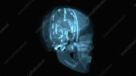 Image result for Add Brain Scan