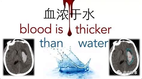 张和教授专栏丨脑出血基础研究情结：血浓于水