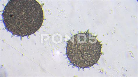 Germs Under Microscope