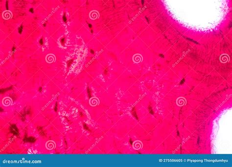 Histological Bone, Elastic Cartilage Human And Joint Of Human Foetus ...