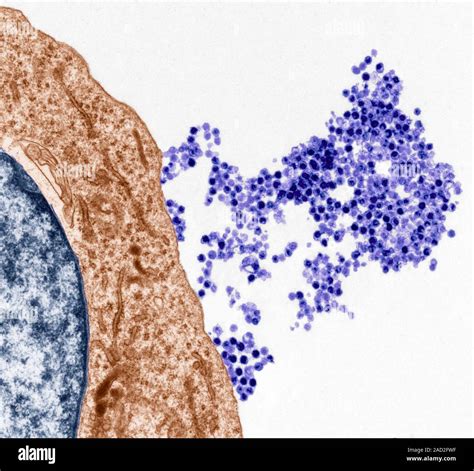 Epstein-Barr virus. Coloured transmission electron micrograph (TEM) of Epstein-barr viruses ...