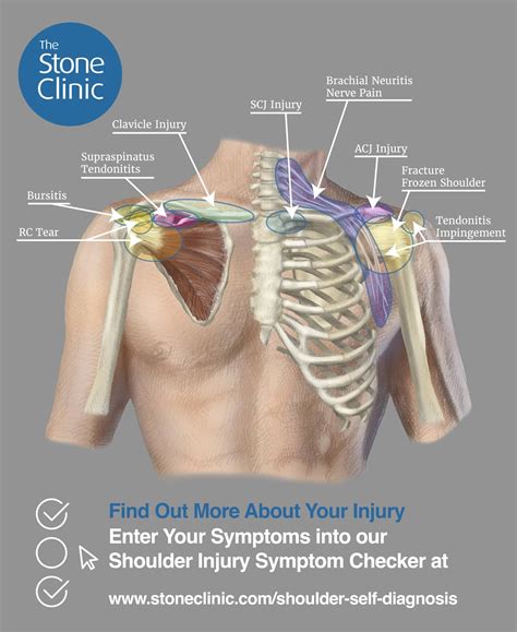 Shoulder Pain Symptom Checker & Pain Diagnosis Chart [Injury Self ...