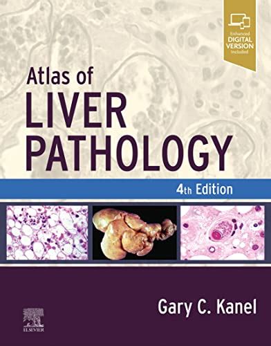 Atlas of Liver Pathology - E-Book (Atlas of Surgical Pathology) eBook ...