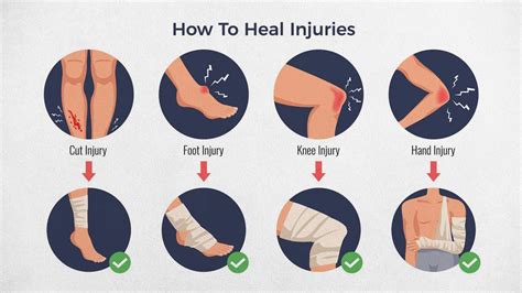sports injuries 的图像结果