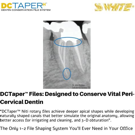 SS White DCTaper™H - Starter Pack - Dentin Conservation Rotary Files ...
