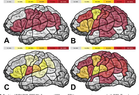Image result for Language Mapping Scan